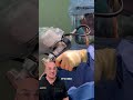 How a Robotic Arm Transforms Hip and Knee Replacement #orthopedics