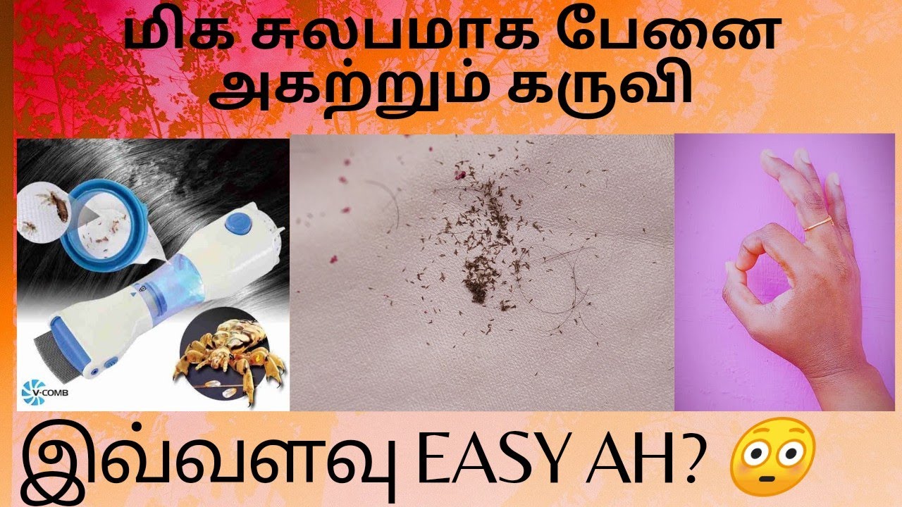 How to Remove Lice From Hair |V comb machine/Anti lice machine/Electric anti lice machine