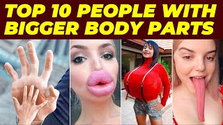 Top 10 Strangest People with Bigger Body Parts Than Normal - These People Have Bigger Body Parts