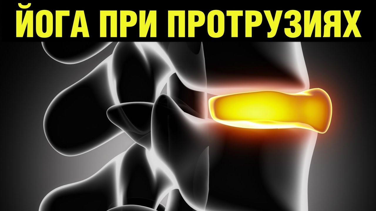 Протрузия диска и упражнения йоги. Утренняя скованность в теле