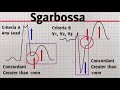 Current ECG Ep 4   Sgarbossa Criteria   STEMI LBBB