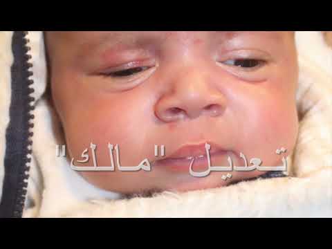 تعديل مالك تقنية جديدة تزيد نسب نجاح جراحة كي الحنفية الي ما يزيد عن ٩٠