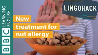 New treatment for nut allergy  Lingohack