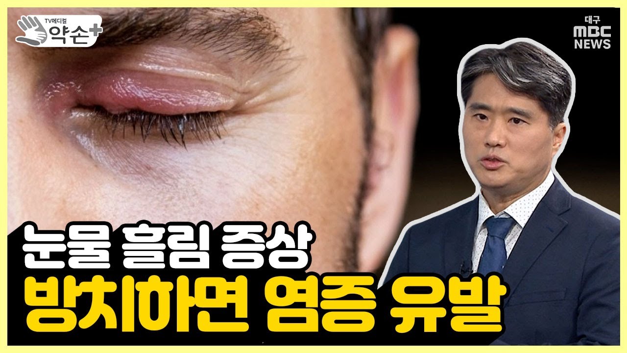 눈물 흘림 증상, 방치하면 염증 유발 ['눈물 흘림' 진단과 치료 ⑭] | 메디컬 약손 - YouTube