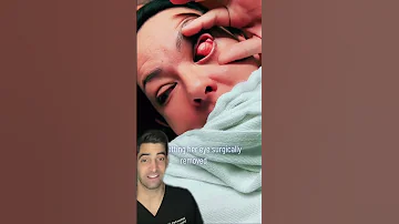 Infection Oculaire 