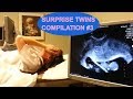 Surprise Twins Ultrasounds Compilation #3