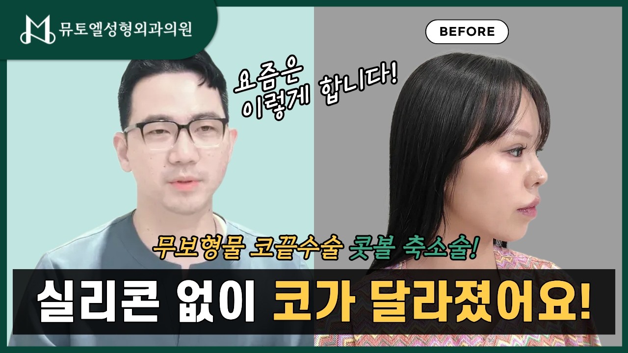 코수술, 꼭 보형물을 넣어야 할까요? 무보형물 코수술의 모든 것👃#코성형#무보형물코수술#무보형물코성형#코끝수술#코끝성형#코끝연장#콧볼축소#콧방울축소#자가조직코성형#자연스러운코성형