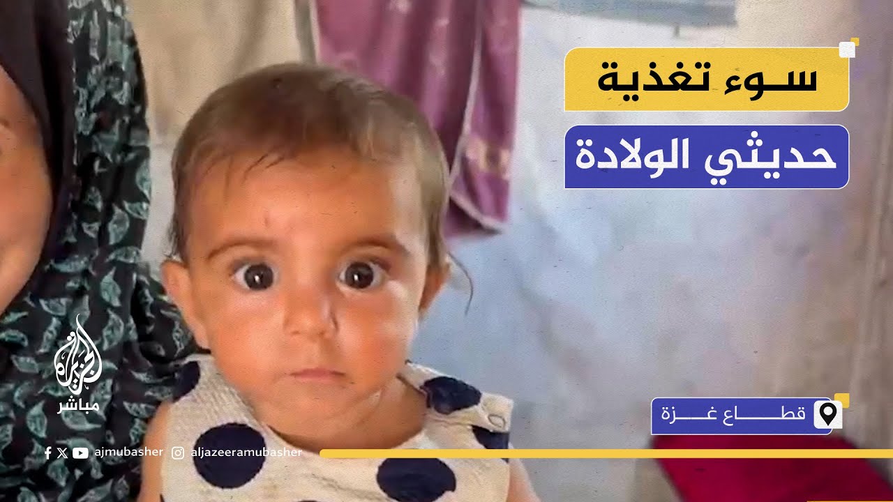 عمرها 8 أشهر وتعاني من سوء التغذية