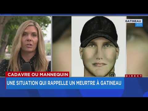 Vidéo: Sveta Ugolek: Mannequin Avec Des Brûlures Sur Plus De 45% Du Corps