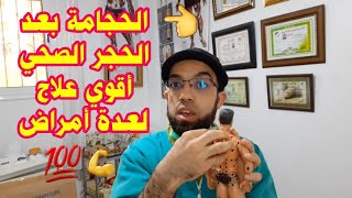 الحجامةبعد الحجر الصحي أقوي علاج لعدة مشاكل الأرق الاعصاب والخمول تنشيط الدورة الدموية للرجال ونساء