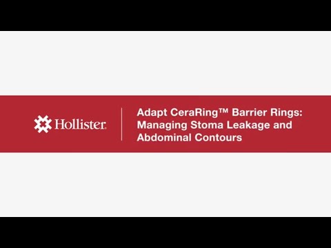 Hollister Adapt CeraRing™