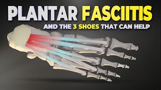 3 Shoes to help with Plantar Fasciitis | @RunMoore