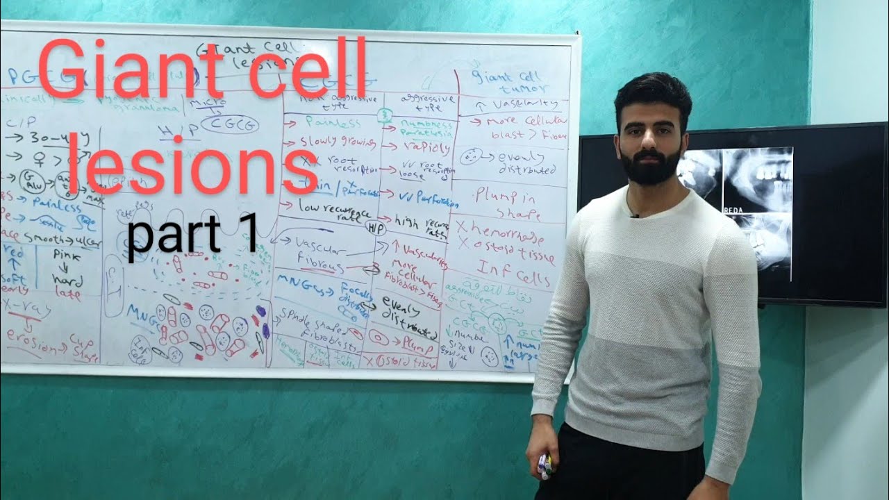 giant cell lesions || part 1 || oral pathology_ عزت شومان