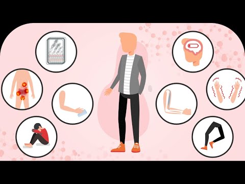 Videó: A sclerosis multiplex kezelése: 15 lépés (képekkel)