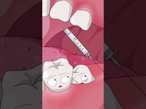 Video: Apabila melihat filem struktur gigi manakah yang radiolusen?