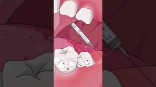 Kenapa sih gigi bungsu tuh harus dicabut?🤔 Karena jika gigi bungsu tidak dicabut, beresiko merusak