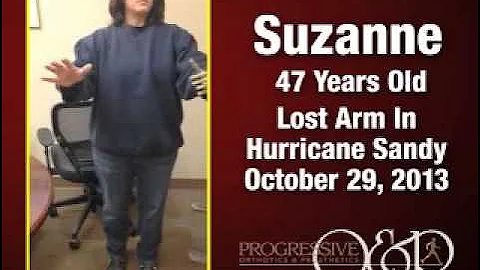 Ottobock Genium™ Knee on Double Amputee