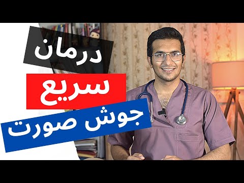 تصویری: چگونه با مرگ والدین کنار بیاییم (همراه با تصاویر)