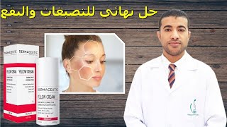 كريم ديرماسيوتيك الأصفر لعلاج كل أنواع التصبغات والكلف Dermaceutic Yellow Cream