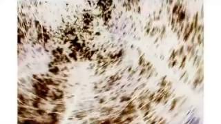 Variousone - Purpling