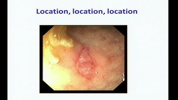 Ground Zero - Impact of Gut Microbiome on Host Epithelial Functions and Responses - Eugene Chang