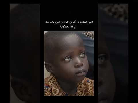 معلومة غريبة جدا العيون الرمادية هي أندر لون للعين بين البشر و3 فقط من الناس يمتلكونها 