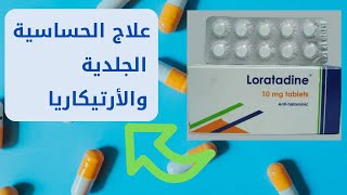 ارخص اقراص لعلاج الحساسية الجلدية والأرتيكاريا (لوراتادين LORATADINE)