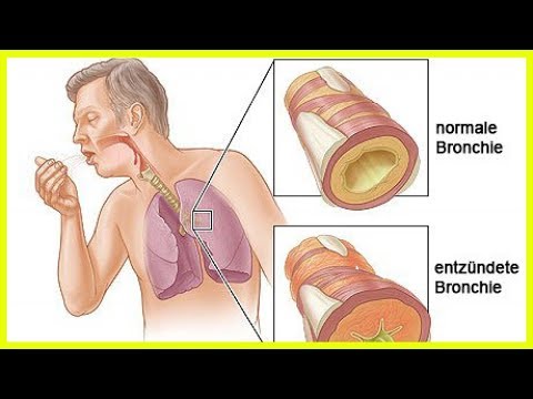 Video: Bananen-Zimmerpflanze: Beschreibung, Pflegeeigenschaften, Fotos und Bewertungen