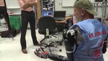 shoulder level amputee modular prosthetic limb  history in the making