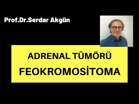 Feokromositoma, Adrenal Tümörü, Serdar Akgün