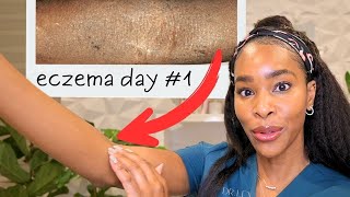 12 Life Changing Tips For Eczema: From a Derm with Eczema screenshot 5