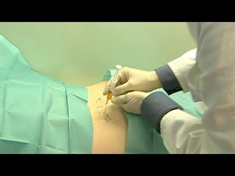 Video: Ar sportininkai vartoja analgetikus?