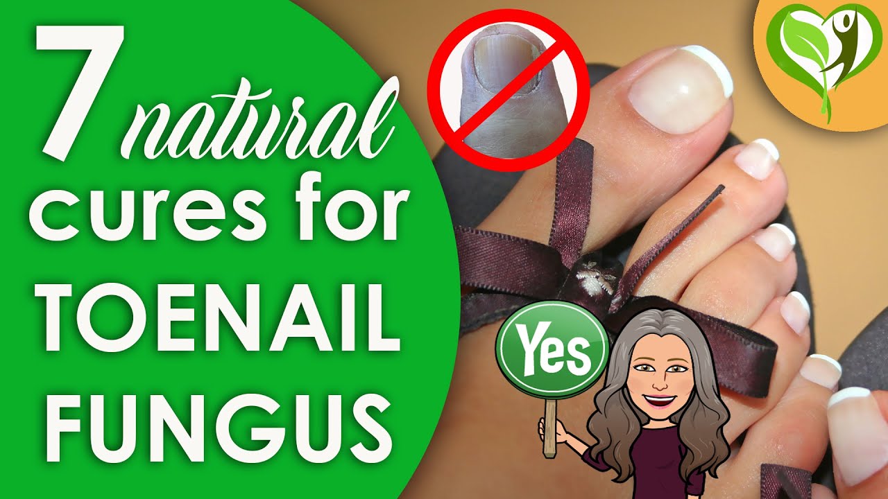 7 Natural cures for toenail fungus