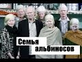 Самая большая в мире семья альбиносов.