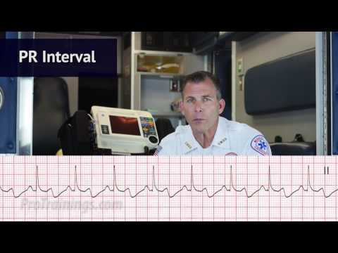 normal-sinus-rhythm-(ecg-interpretation)