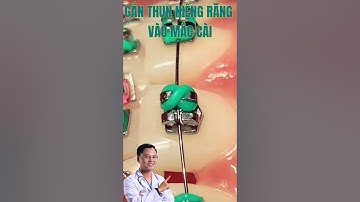 Video quá trình gắn thun niềng răng vào mắc cài #drcuong #niengrang #nhakhoa
