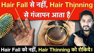 Hair Fall से नहीं, Hair Thinning से गंजापन आता है॥