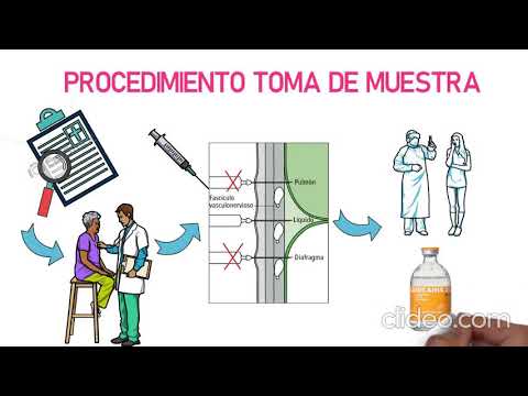 Vídeo: Com es forma el líquid pleural?