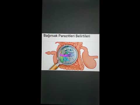 Video: Göç eden kutanöz larva sendromu - nedenleri, belirtileri ve tedavisi