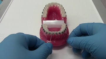 How to Use Superfloss