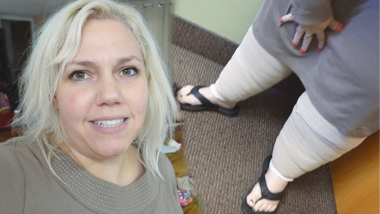 Lipedema Leg Wrap Treatment First Time YouTube