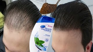 Put this ingredient in your shampoo 🌱 It speeds up hair growth and treats baldness