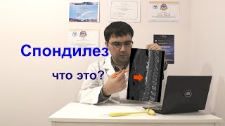 Спондилез: что это такое?