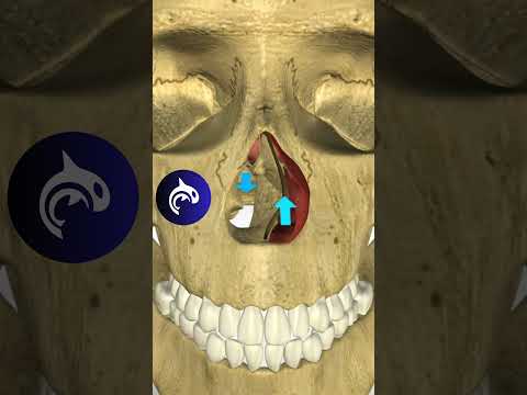 See what happens when you have a Deviated Septum #breathing #deviatedseptum #sleepapnea