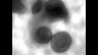 Four Interacting Protocells