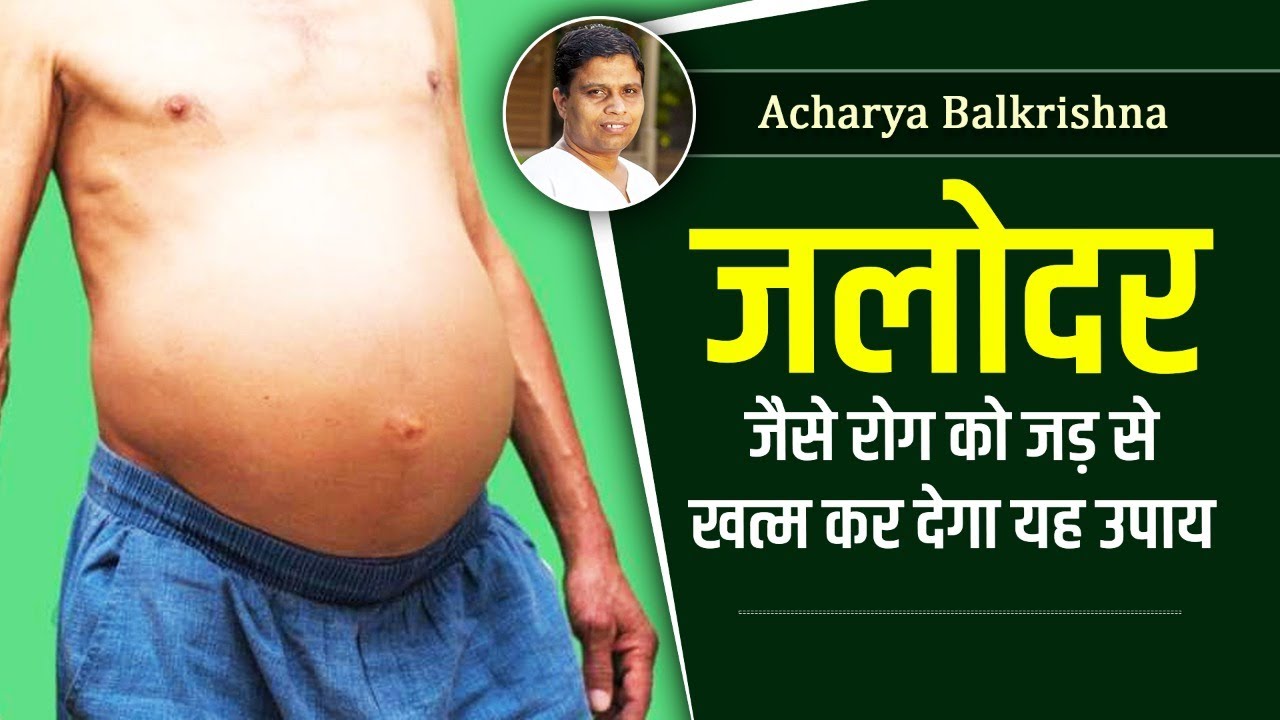 Ascites Ke Liye Gharelu Upay aur Savdhaniyan (Ascites के लिए घरेलू उपाय और सावधानियां)