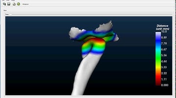 TMJ contact area analysis