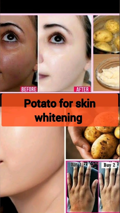 How to use potato for skin whitening😱 Potato scrub for skin whitening🤩and darks spots removal#shorts