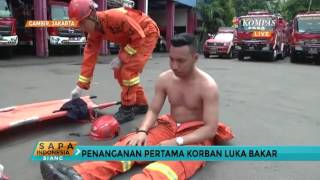 Tips mengatasi luka bakar 10 hari sembuh tak berbekas #Tips #mengatasi #lukabakar