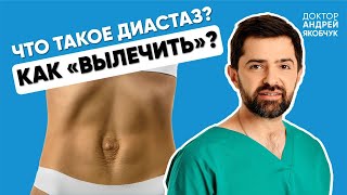 Что такое диастаз, как убрать диастаз, пресс и диастаз, опасность диастаза: доктор Андрей Якобчук